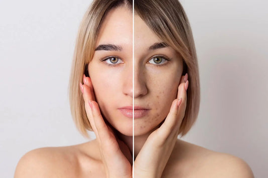 Reduce Skin Pigmentation