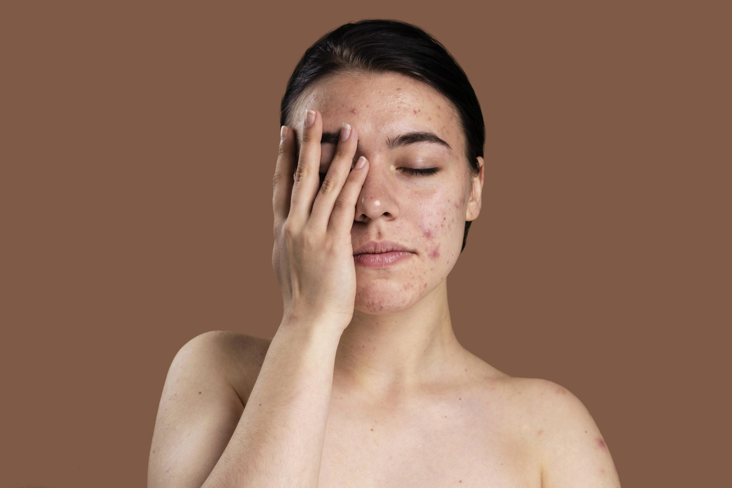 Eczema Treatment How to Choose the Right Skincare Ingredients? SkinbydrG