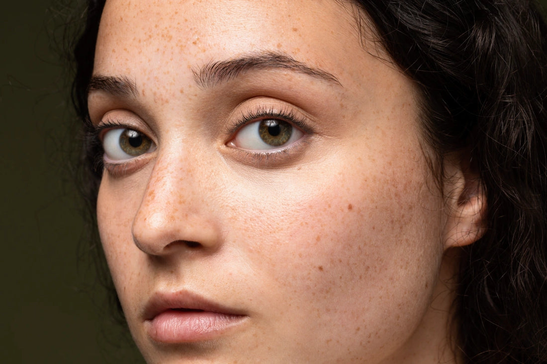Three  Ingredients for Pigmentation Removal
